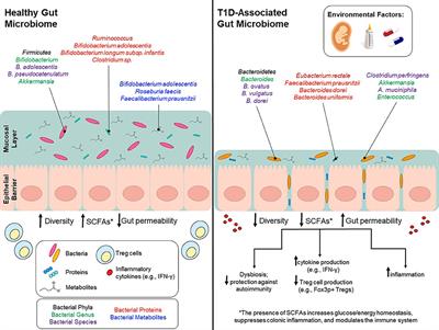 The Role of Gut Microbiota and Environmental Factors in Type 1 Diabetes Pathogenesis